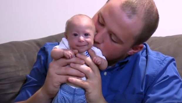 This 7-Month-Old Baby Has Dwarfism, Causing Him to Stay ...