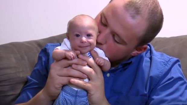 this-7-month-old-baby-has-dwarfism-causing-him-to-stay-the-size-of-a