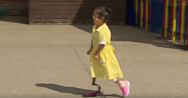 New Prosthetic Leg For 7 Year Old Anu Welcomed By Classmates In Video