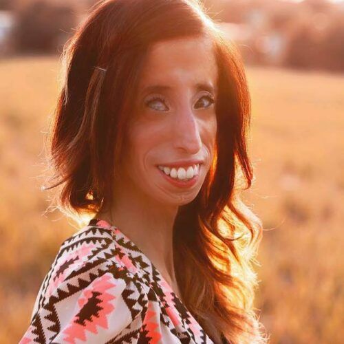 Lizzie Velasquez